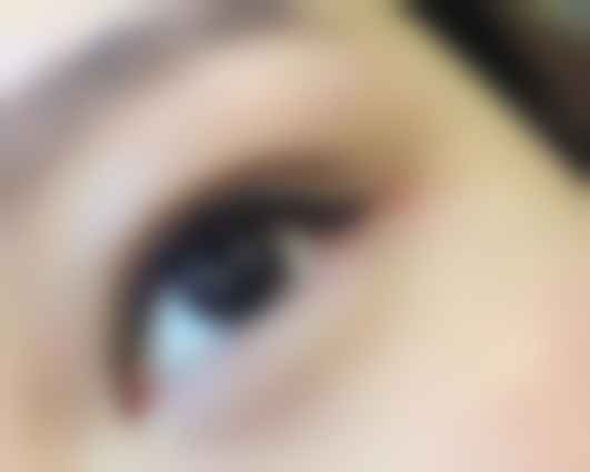 植发后有哪些护理建议呢？