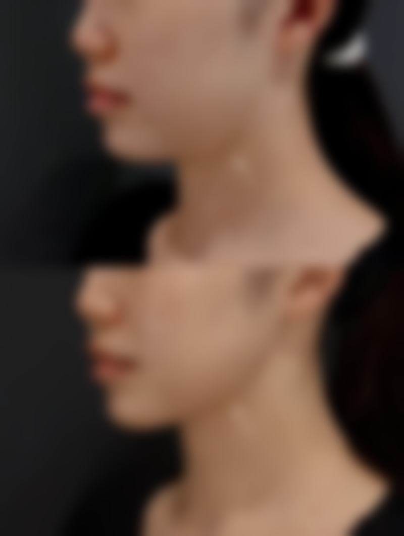 有哪些适用的改善手段呢？