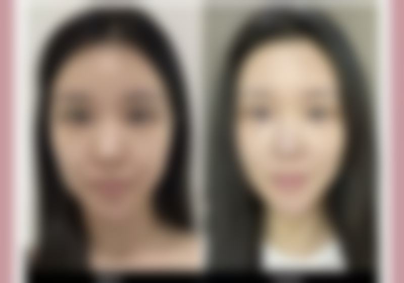 无锡可琳雅医疗整形医院正规吗？