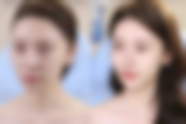 无锡可琳雅医疗整形医院怎么预约