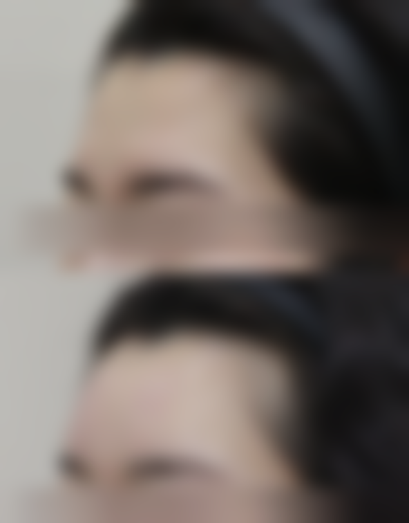 福州明宇医疗美容诊所崔英焕医生患者评价