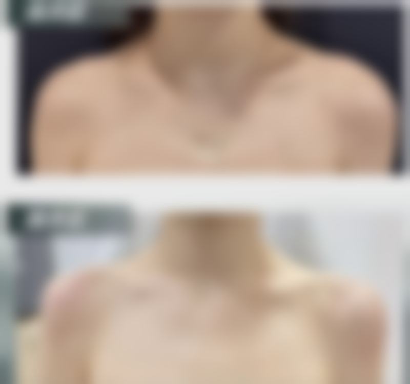 福州明宇医疗美容诊所崔英焕医生瘦脸技术怎么样?