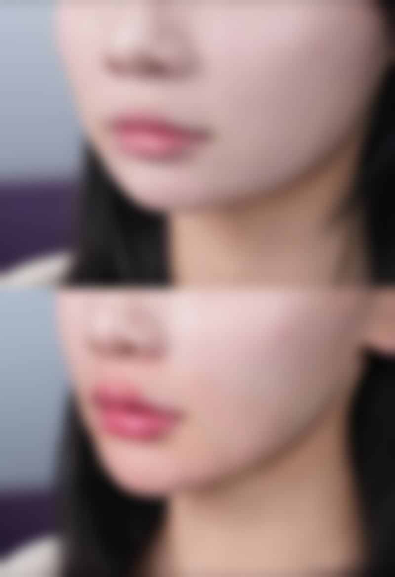 成都成华科美之光整形正规吗？