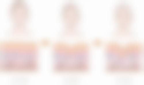 除了致命风险，假体隆胸还有其他相关风险吗？