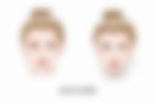 无锡市--江阴首佳植发美容诊所口碑评价怎么样？