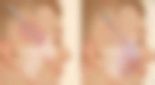 假体大小的选择和生命危险有关系吗？