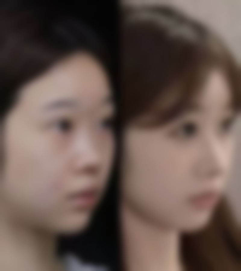 江西 南昌术丽易美整形医院怎么预约