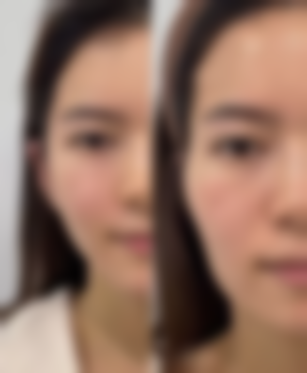 宁波海曙珈禾美容整形医院口碑评价怎么样？