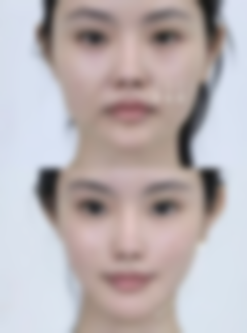 无锡市--江阴首佳植发美容诊所正规吗？