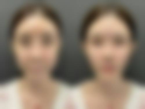 杭州芒塔玖橙整形医院口碑评价怎么样？