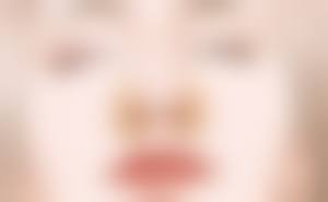 武汉壹加壹整形医院李艳东医生眼部整形技术怎么样？