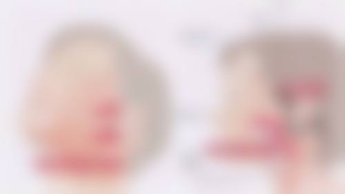 韩国Nature整形外科黄正勋医生擅长项目