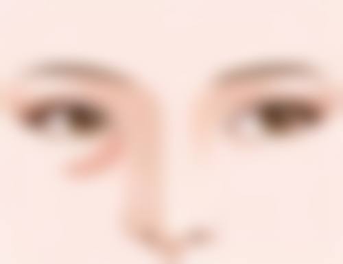 眼部吸脂手术会留下疤痕或瘢痕增生吗？