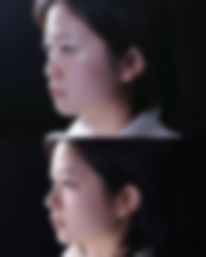 福州隆美尔整形医院正规吗？