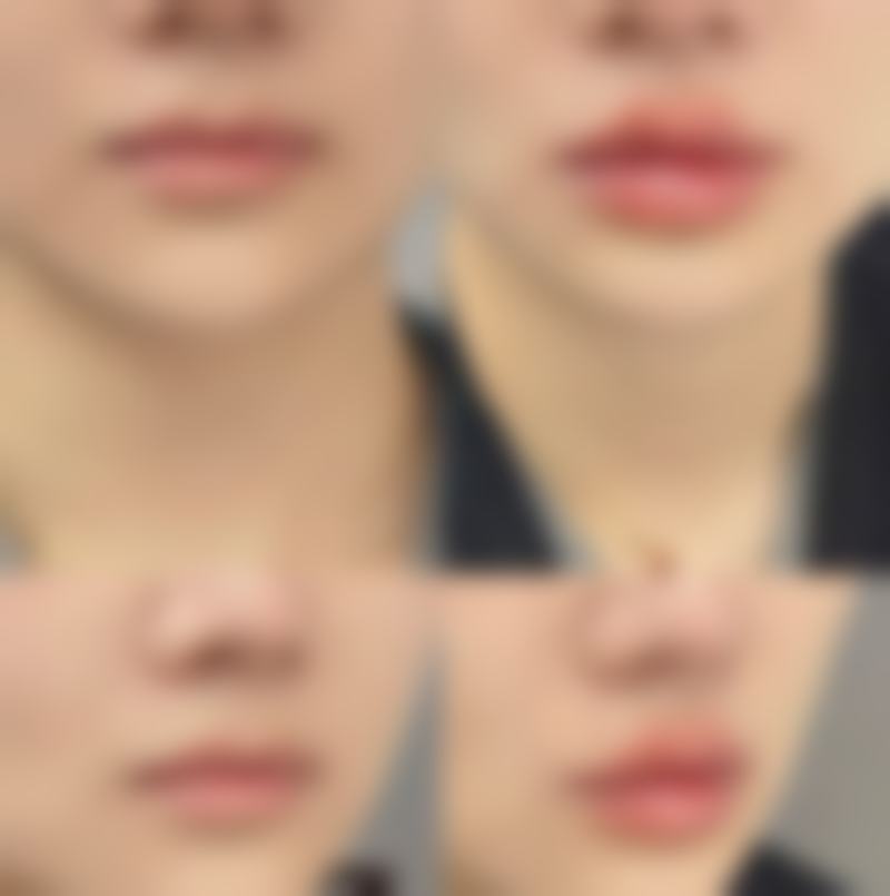 韩国Nature整形外科黄正勋医生患者评价