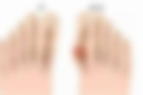 腰腹环吸和腰腹抽脂哪个成效更持久？