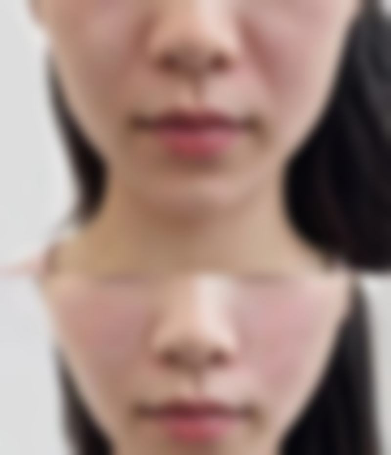 遂宁茜熙智雅医疗美容诊所正规吗？