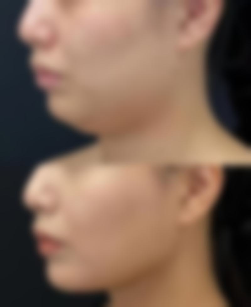 玉林华美整形医院怎么预约