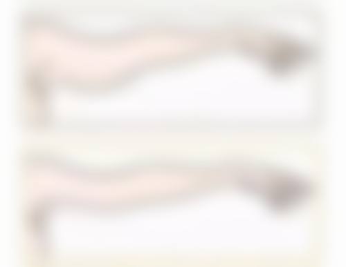 厦门174医院整形美容科米增法医生擅长项目