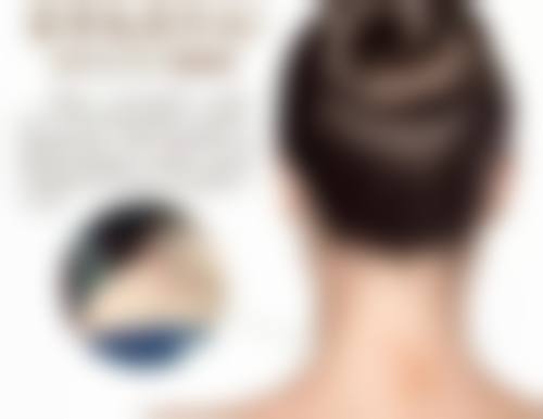 手术治疗疤痕疙瘩是怎样的呢?