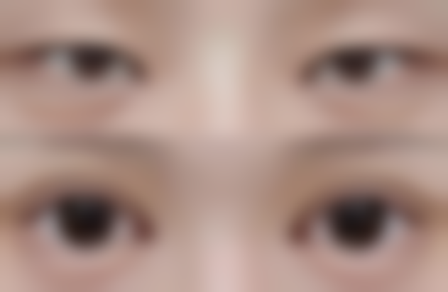 厦门174医院整形美容科米增法医生预约挂号指南