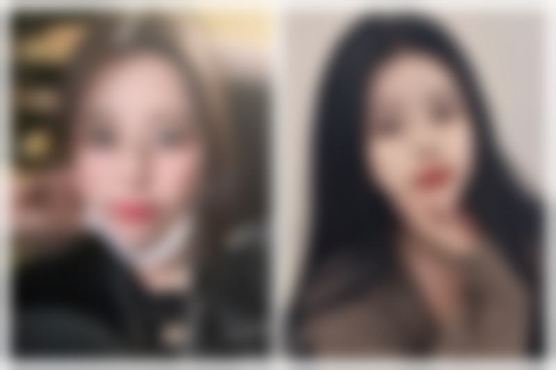 上海嘉会整形医疗诊所(静安)楼晓莉医生面部年轻化手术技术怎么样?