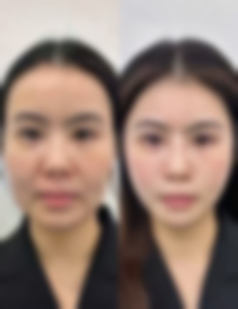 北京伊士波医疗美容门诊部谢岚医生擅长项目