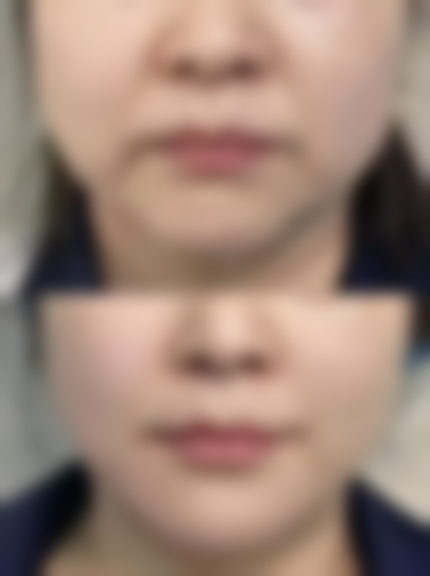 张掖忆莲医疗美容诊所正规吗？