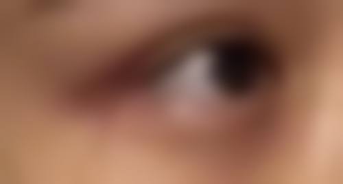 昆明市中医医院整形美容科正规吗？