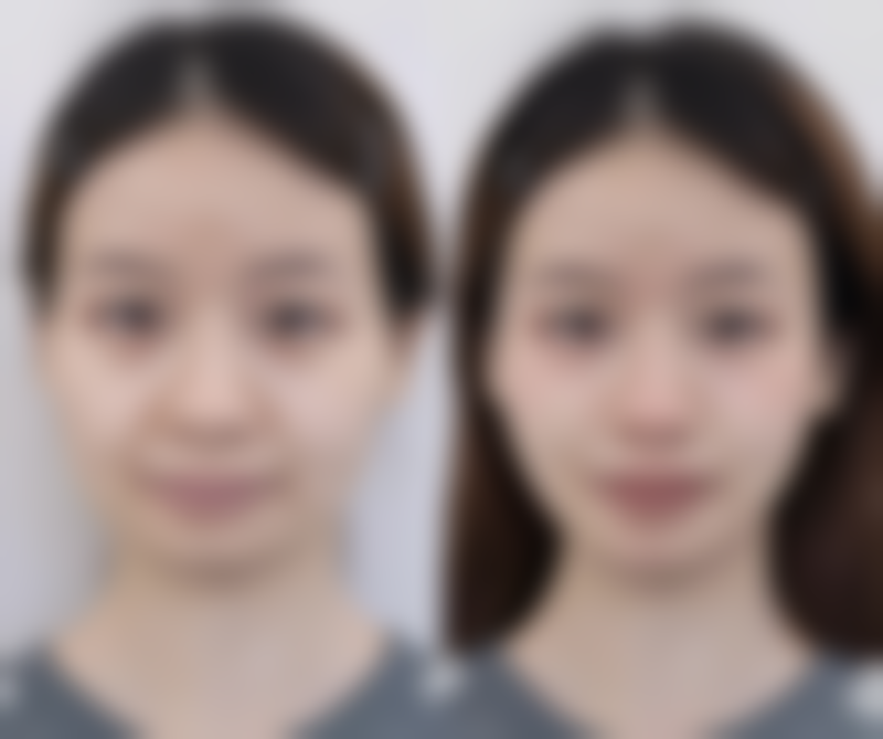 深圳市福田人民医院整形外科正规吗？