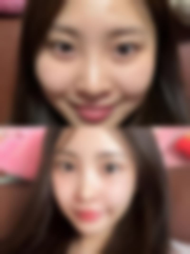 如何才能去掉黑眼圈和眼袋？日常护理能起到作用吗？