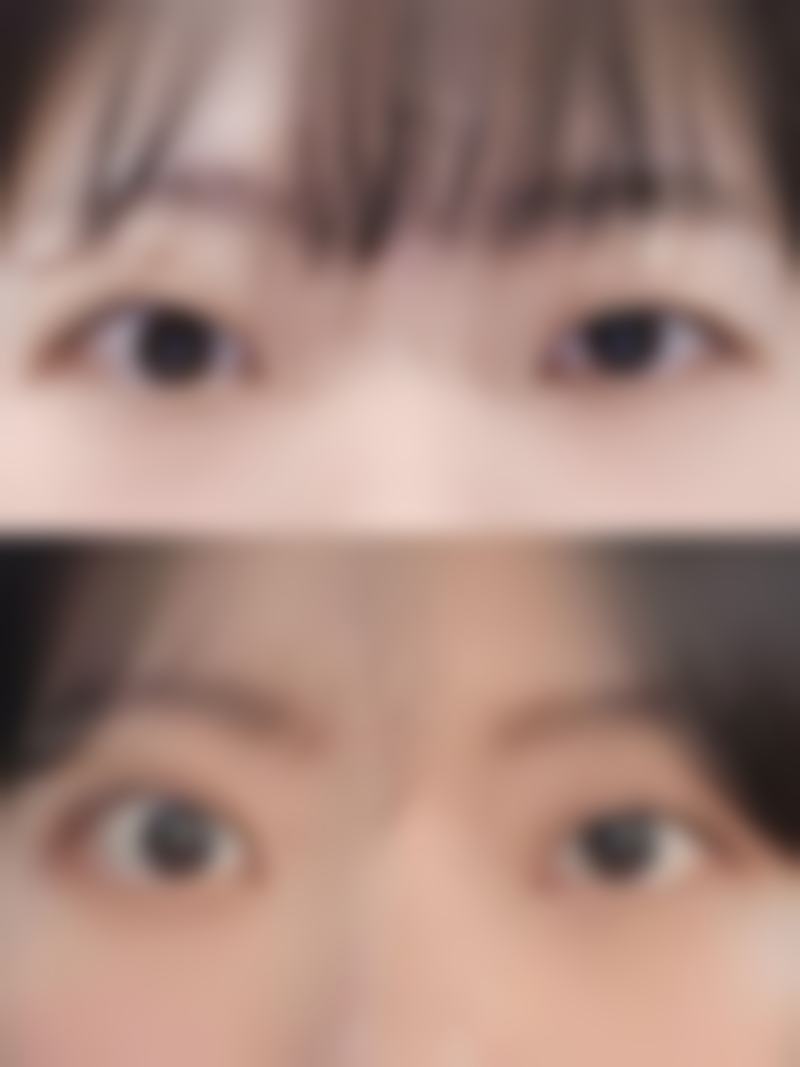 如何才能去掉黑眼圈和眼袋？运动对改善它们有帮助吗？