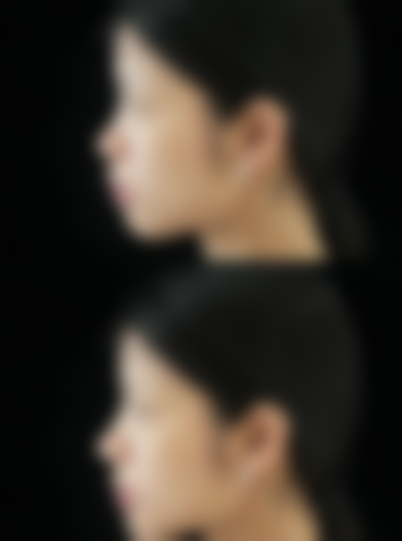 北京瑞妍茗医整形美容医院口碑评价怎么样？