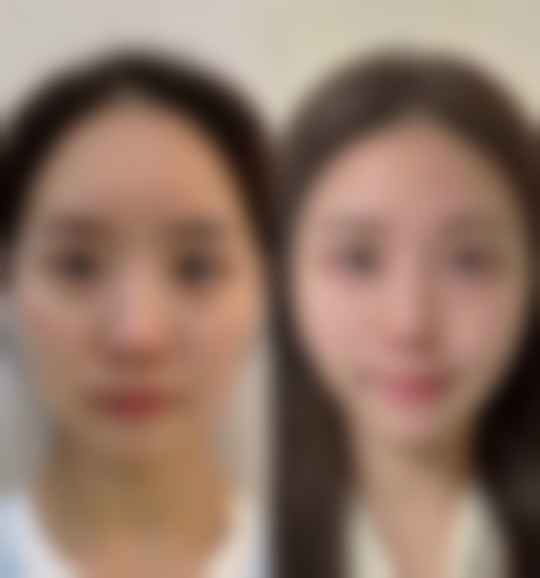 深圳市福田人民医院整形外科口碑评价怎么样？