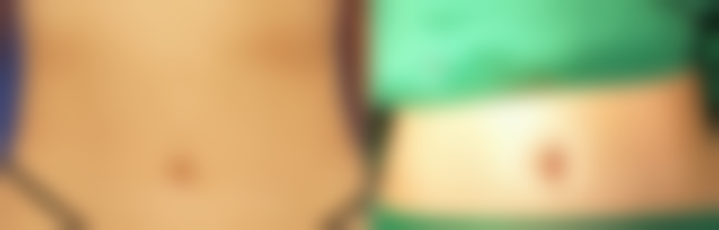 天津佳艺医疗美容诊所张守玲医生收费价格