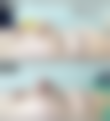 长春朝阳麦西美嘉医疗美容诊所吕鹏飞医生眼部修复技术怎么样？