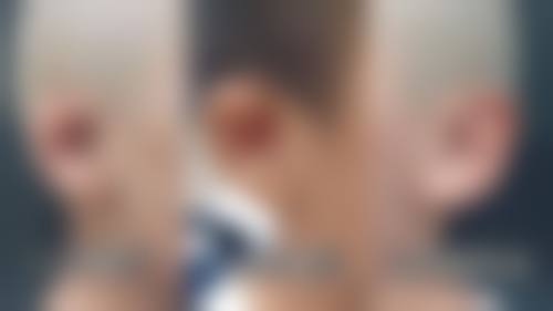 广州科诗颜医疗美容门诊部严若华医生预约挂号指南