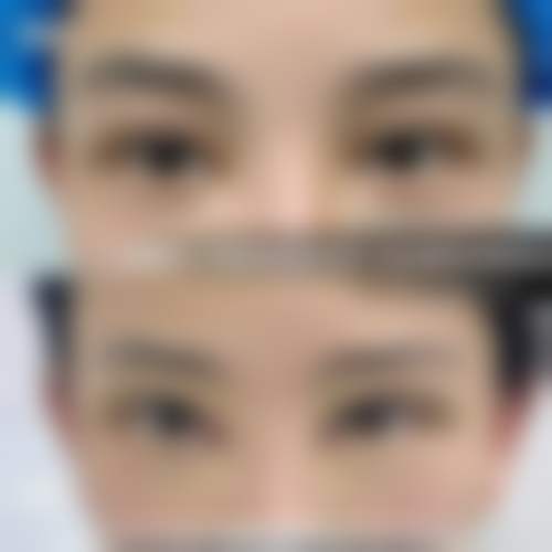 福州协和医院整形科正规吗?