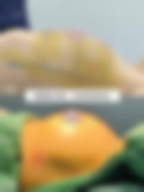 福州协和医院整形科收费价格表