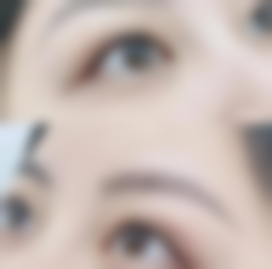 抽脂法眼袋术危险吗？正规操作下风险可控，选对医院医生可有效降低风险！ 