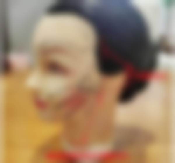 北京黄寺医疗美容门诊部赵峰之鼻部整形项目