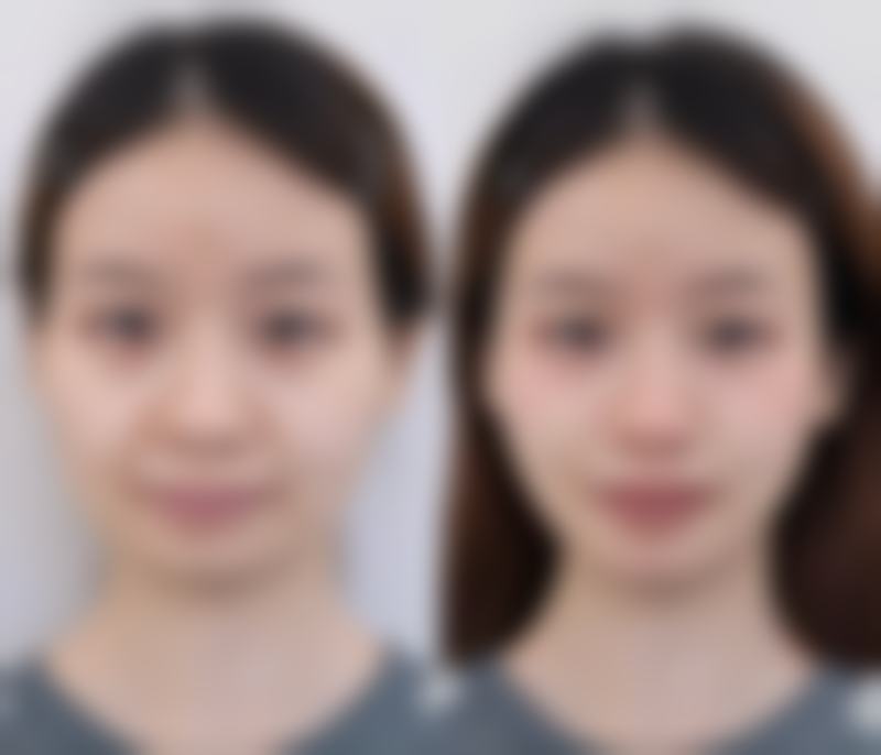 澜沧熹美人整形医院正规吗?