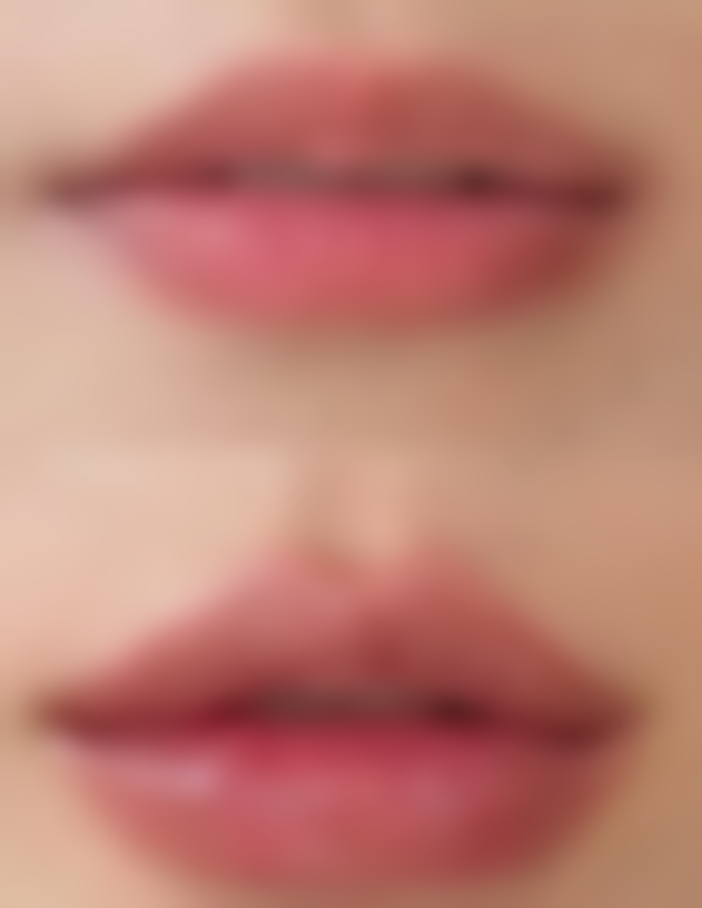 韩国247Clinic整形外科医院口碑评价怎么样？