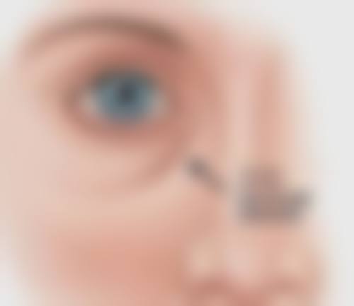 骨干医生们对这两种隆鼻方式的安心性有什么看法呢?