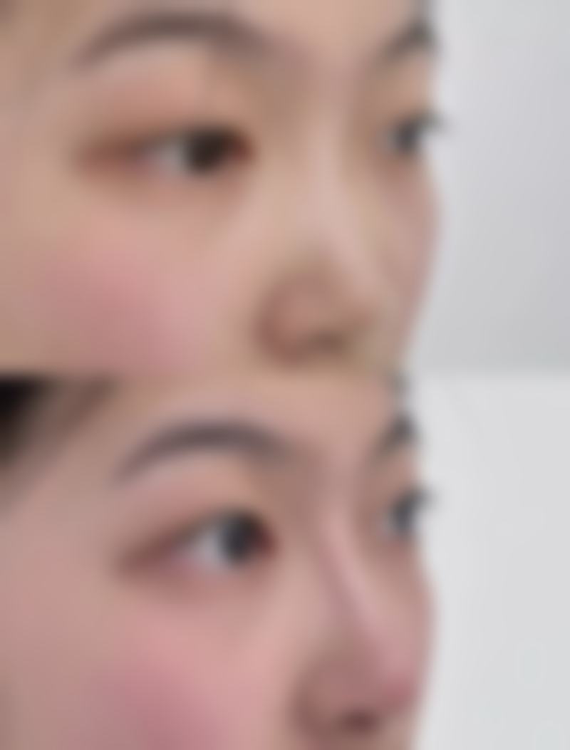 术后并发症对维持时间有什么影响？