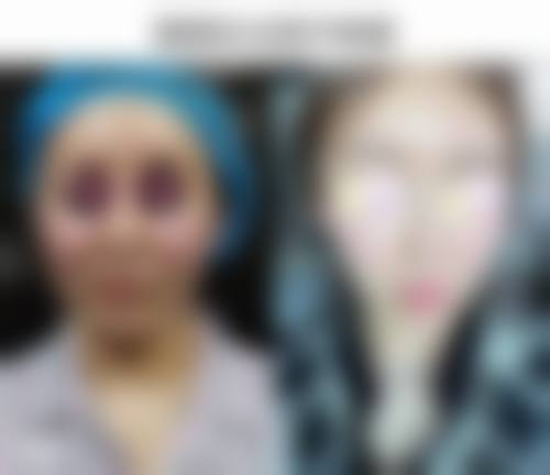 广州艾沫尔医疗美容皮肤科口碑评价怎么样？