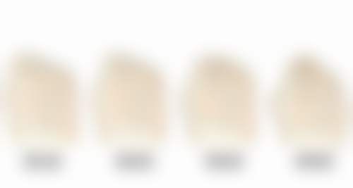 哪些人适合硅胶隆鼻，哪些人适合膨体隆鼻？