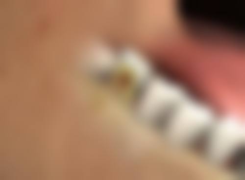 无锡第三人民医院烧伤整形科杨敏烈医生擅长项目