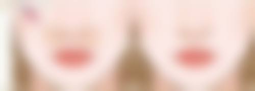 膨体和硅胶的材料稳定性如何？