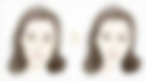 膨体和硅胶隆鼻的维持时间一样吗？